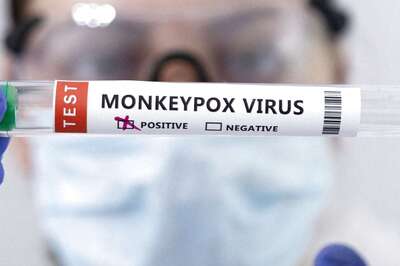A.2 Strain Found in Two Indian Monkeypox Cases; All You Need to Know About its Symptoms, Virulence & Difference with B.2