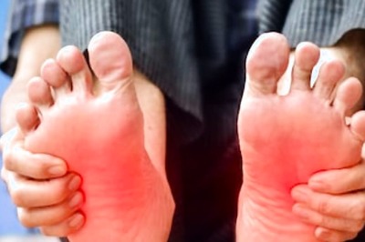 Vitamin Deficiency To Kidney Infection, Reasons Behind Burning Sensation In Feet