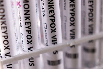 Fever, Skin Rash: Delhi's Monkeypox Patient Showed These Symptoms; Doctor Says Condition is Stable