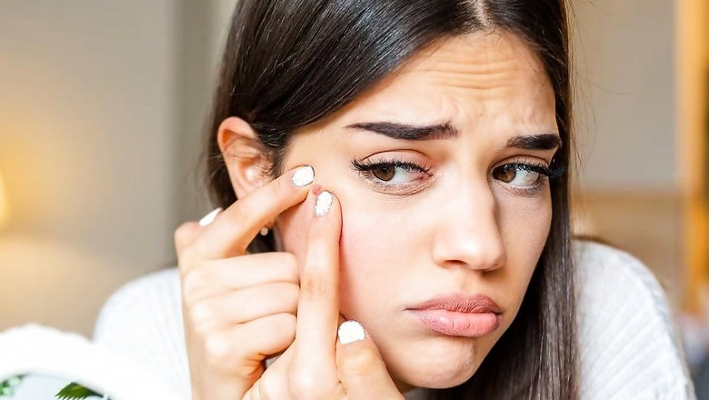 10 Signs Why You Need To Visit Your Dermat After 20’s
