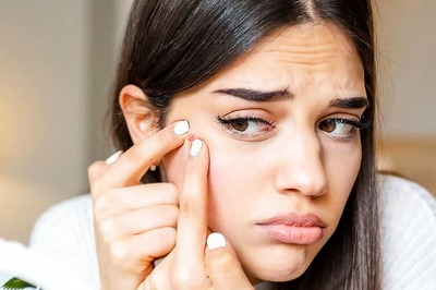 10 Signs Why You Need To Visit Your Dermat After 20’s