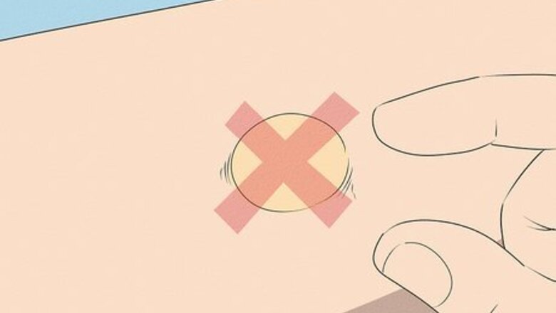 How to Pop a Blister