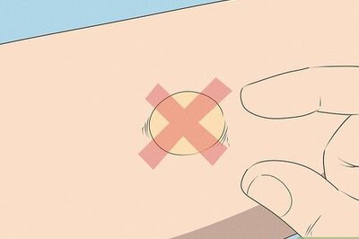 How to Pop a Blister