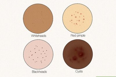 What Do Clogged Pores Look Like? Identify and Unclog Them