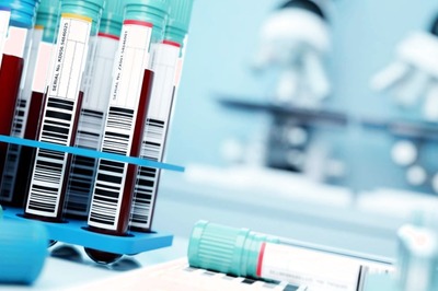 Russia Warns of West Nile Virus: Know All About the Mosquito-borne Disease that Can Cause Deadly Nervous Condition