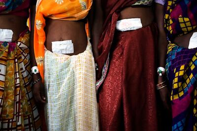 India’s Family Planning Mission Puts Burden of Sterilisation on Women at the Cost of Their Health