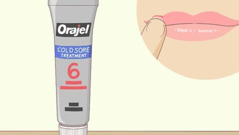 How to Get Rid of a Cold Sore