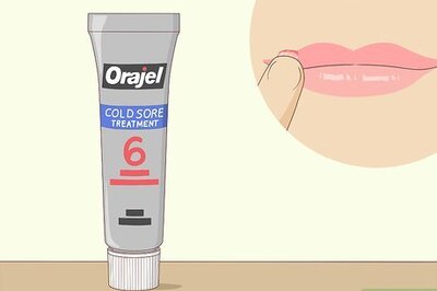 How to Get Rid of a Cold Sore