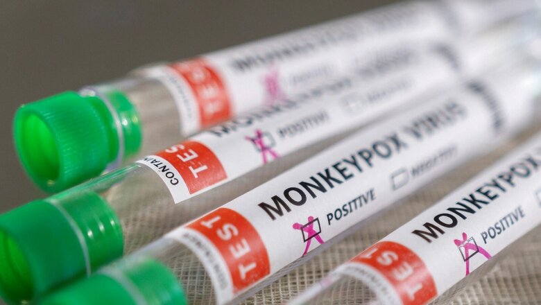 Centre Forms Task Force to Closely Monitor Monkeypox Virus Situation in Country