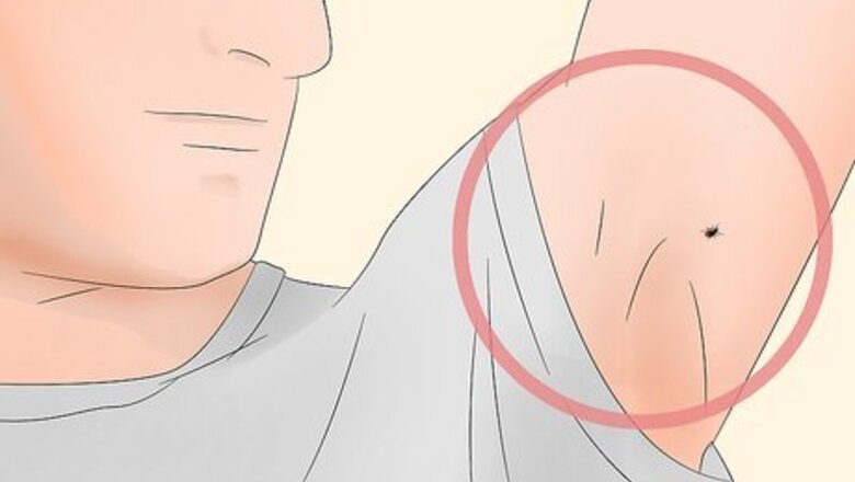 How to Identify Tick Bites