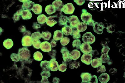 Korean Man Dies from 'Brain-eating Amoeba'. What is Naegleia Fowleri, Is It Present in India? EXPLAINED