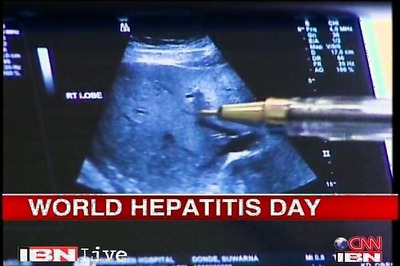 Hepatitis B carrier state has no symptoms: Dr Vivek Raj