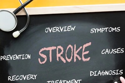 World Stroke Day: What Should One Do When Experiencing A Stroke?