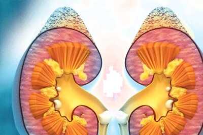 Kidney Transplant 101: What You Need to Know