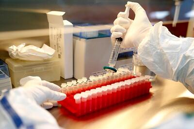 Could COVID-19 Spread More in the Winter Season?