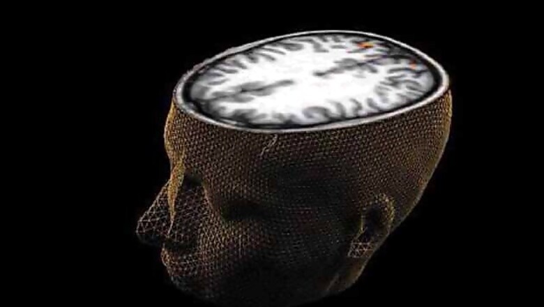 Scientists map how brain organises everything we see