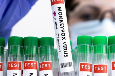 People Need Not Worry about Monkeypox, Vaccination Tougher than Covid: Top Virologist | Exclusive