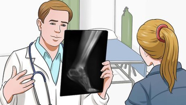 How to Heal Broken Bones