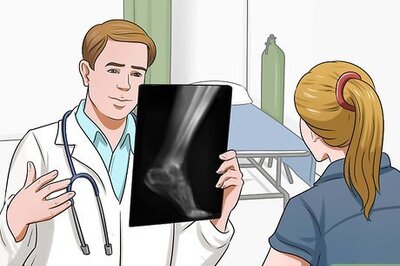 How to Heal Broken Bones