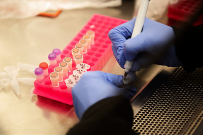 Covid-19 Rapid Antibody Test Kit Use Put on Hold, ICMR to Check Accuracy: Official Source