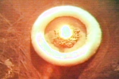 How Over 100 Nuclear Tests, Conducted Four Decades Ago In This Kazakhstan City, Still Affect Its Residents