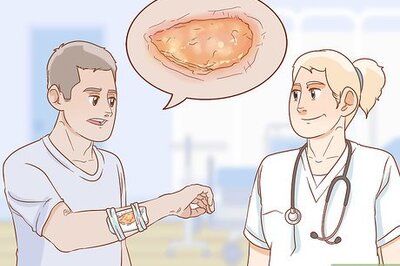 How to Treat an Infected Burn