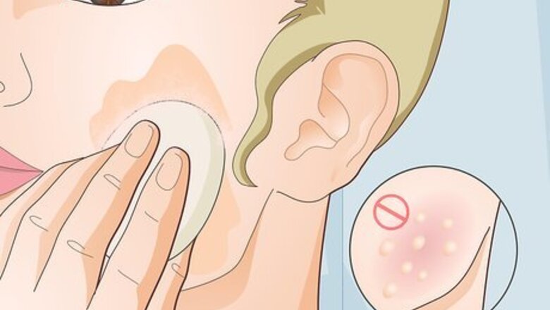 How to Cover Up a Sunburn