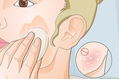 How to Cover Up a Sunburn