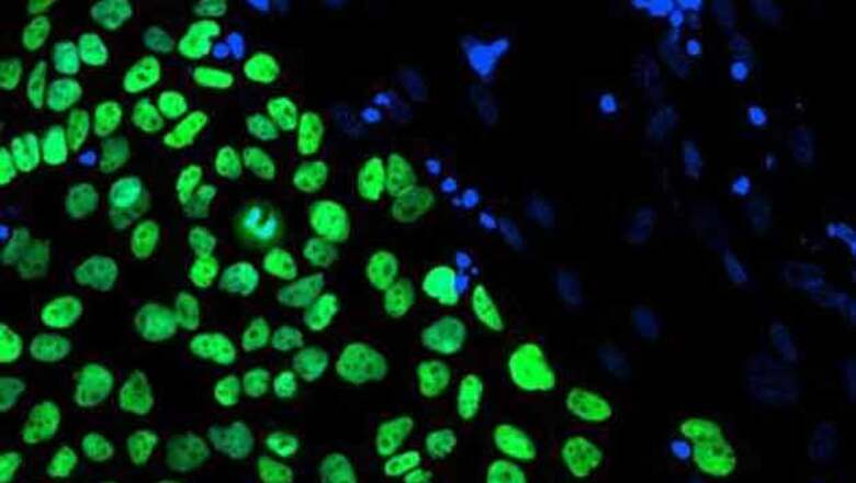 Scientists finally create human stem cells through cloning