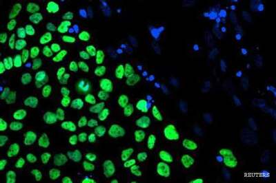 Scientists finally create human stem cells through cloning