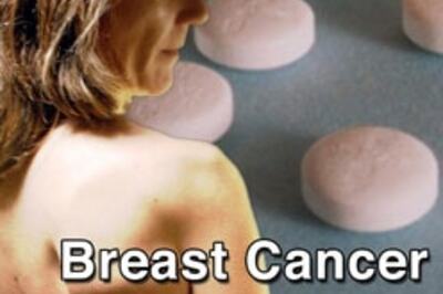 Added gene risk for breast cancer: study