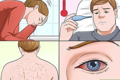 How to Recognize Zika
