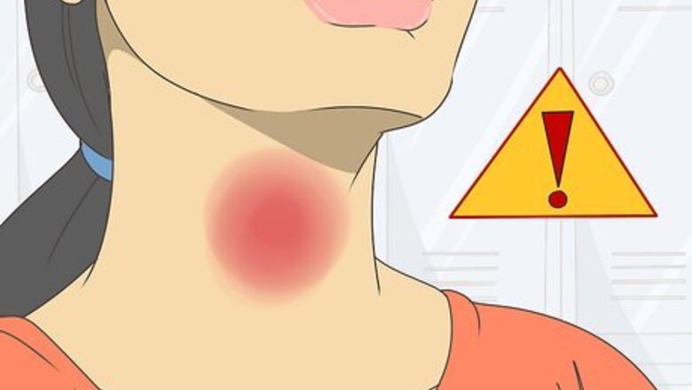 How to Treat Thyroid Problems
