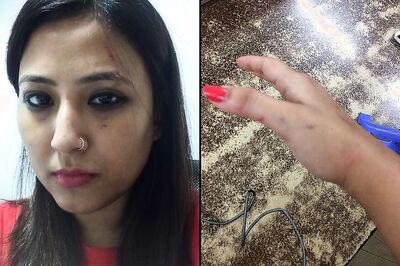 Hair Yanked Out, Face Scratched: Mumbai Woman's Horror Uber Pool Trip After Tiff Over Last Drop