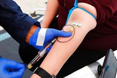 Large Antibody Study Offers Hope For Virus Vaccine Efforts