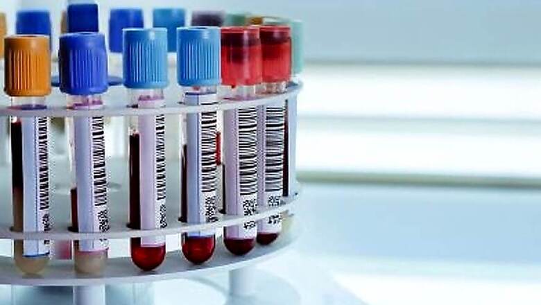 Baxter India Gets CDSCO Nod for Use of Its Oxiris Filter in Covid-19 Treatment