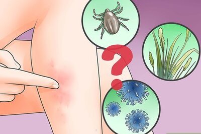 How to Treat a Skin Infection
