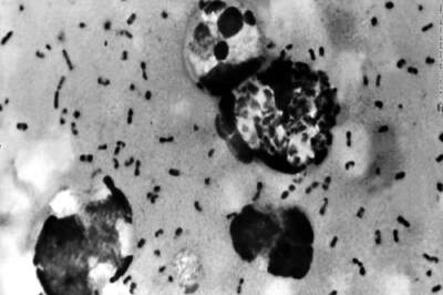 Everything to Know About Bubonic Plague As It Spreads Again