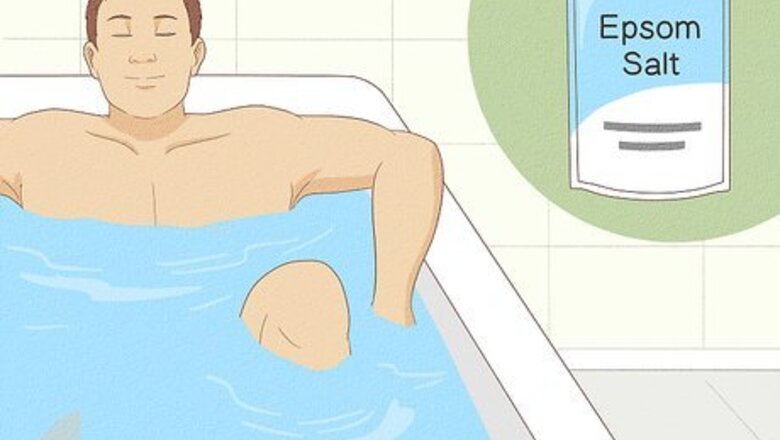 How to Cure a Hydrocele