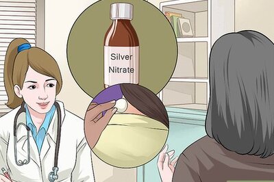 How to Cauterize an Open Wound