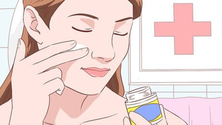 How to Treat Acne (Teenage Girls)