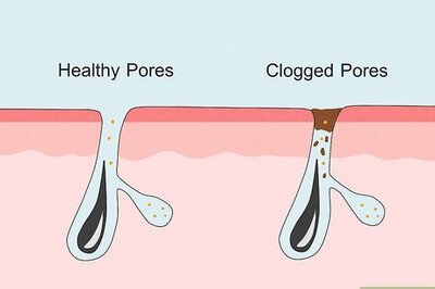 How to Clean Clogged Pores