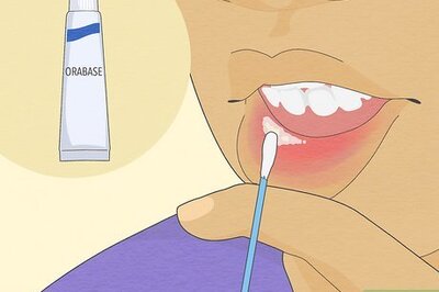 How to Cure Mouth Ulcers Quickly & Naturally