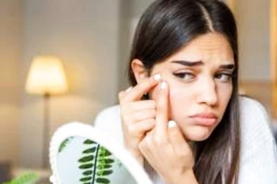 Skincare Tips: Unorthodox Methods For Acne Reduction That You Should Never Try Out