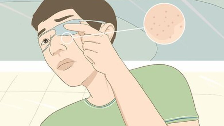 How to Wear an Eyepatch