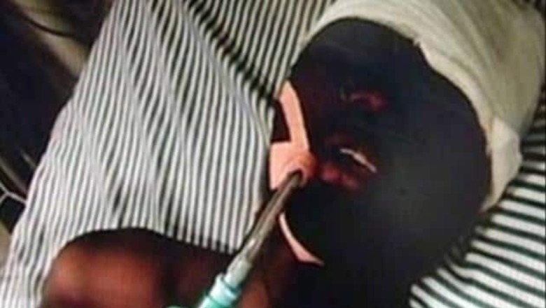 Burundi student attack case: One more arrested