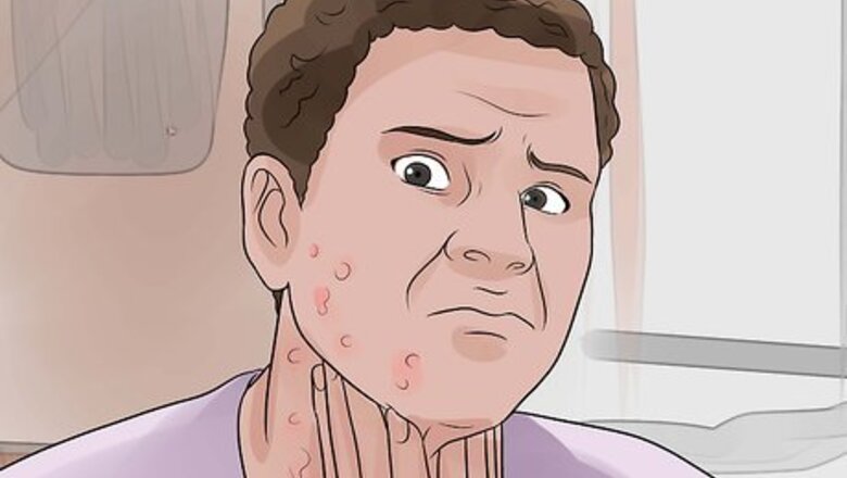How to Recognize and Prevent Rubella (German Measles)