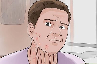 How to Recognize and Prevent Rubella (German Measles)