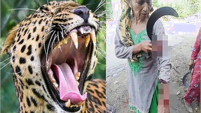 Elderly Woman Fights off Leopard in Himachal Pradesh, Sustains Injuries