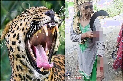 Elderly Woman Fights off Leopard in Himachal Pradesh, Sustains Injuries